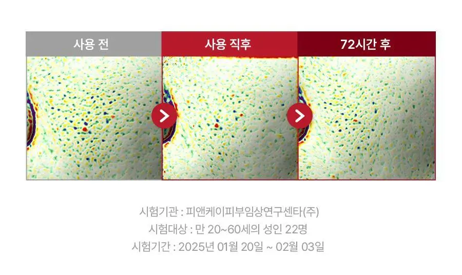 [각질케어 앰플] 메이영 모공 리페어 스피큘 필링 앰플 50ml 상세페이지 23